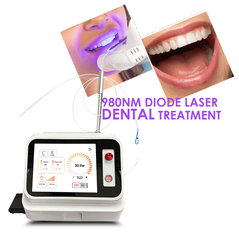 2024 Hot Sale Dental Soft Tiss - đánh giá và giá Teeth Whitening With Laser