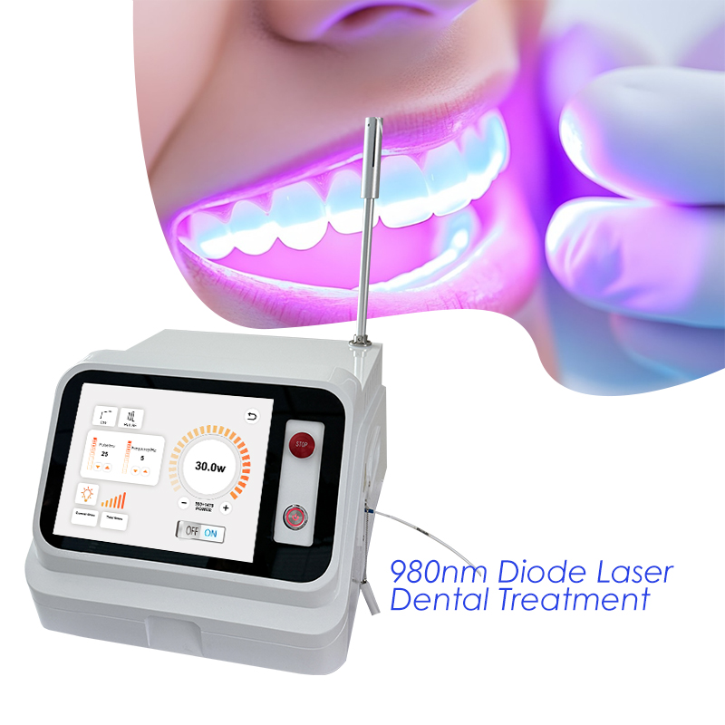 2024 Hot Sale Dental Soft Tiss - đánh giá và giá Teeth Whitening With Laser