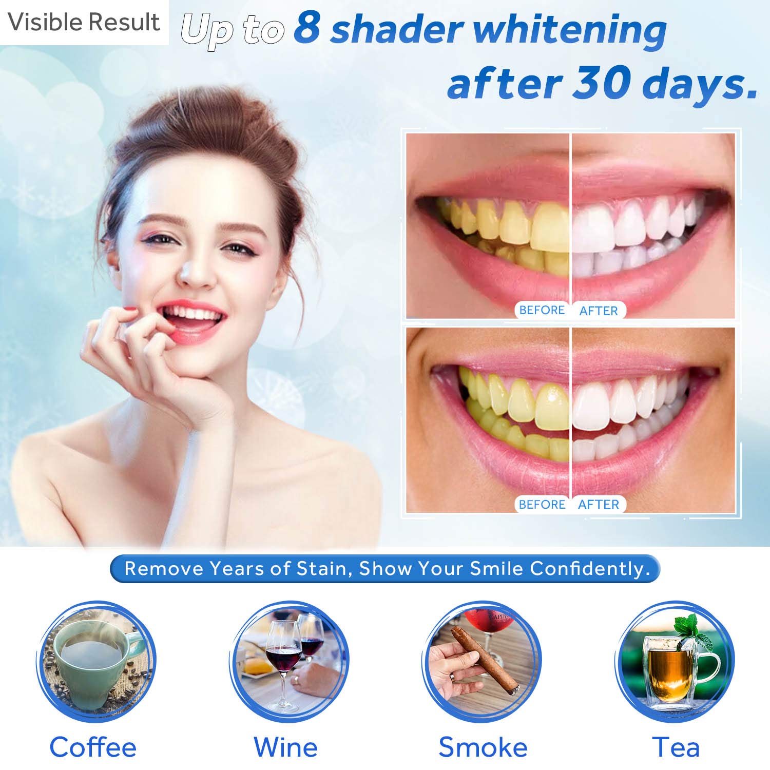 Teeth Whitening Gel Refill Syr - đánh giá và giá Teeth Whitening Near Me