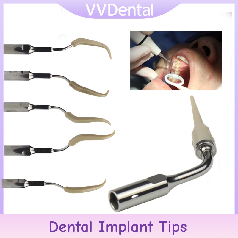 VV Dental Ultrasonic Scaler Im - đánh giá và giá Teeth Whitening Tips