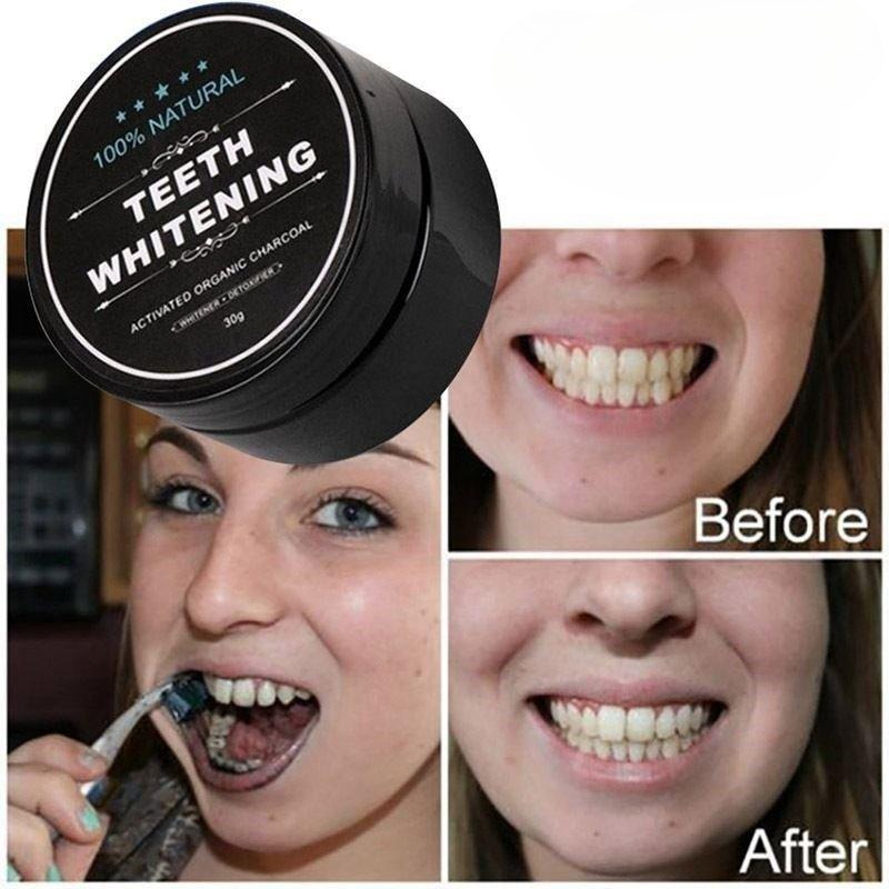 1 Box Activated Charcoal Teeth - đánh giá và giá Teeth Whitening Quotes