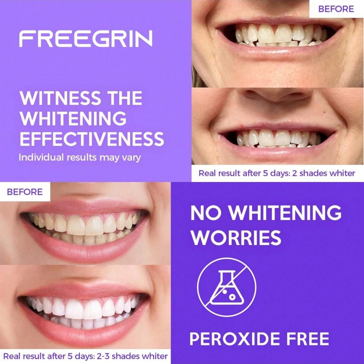 Deluxe Whitening Teeth Sticker - đánh giá và giá Teeth Whitening Quotes