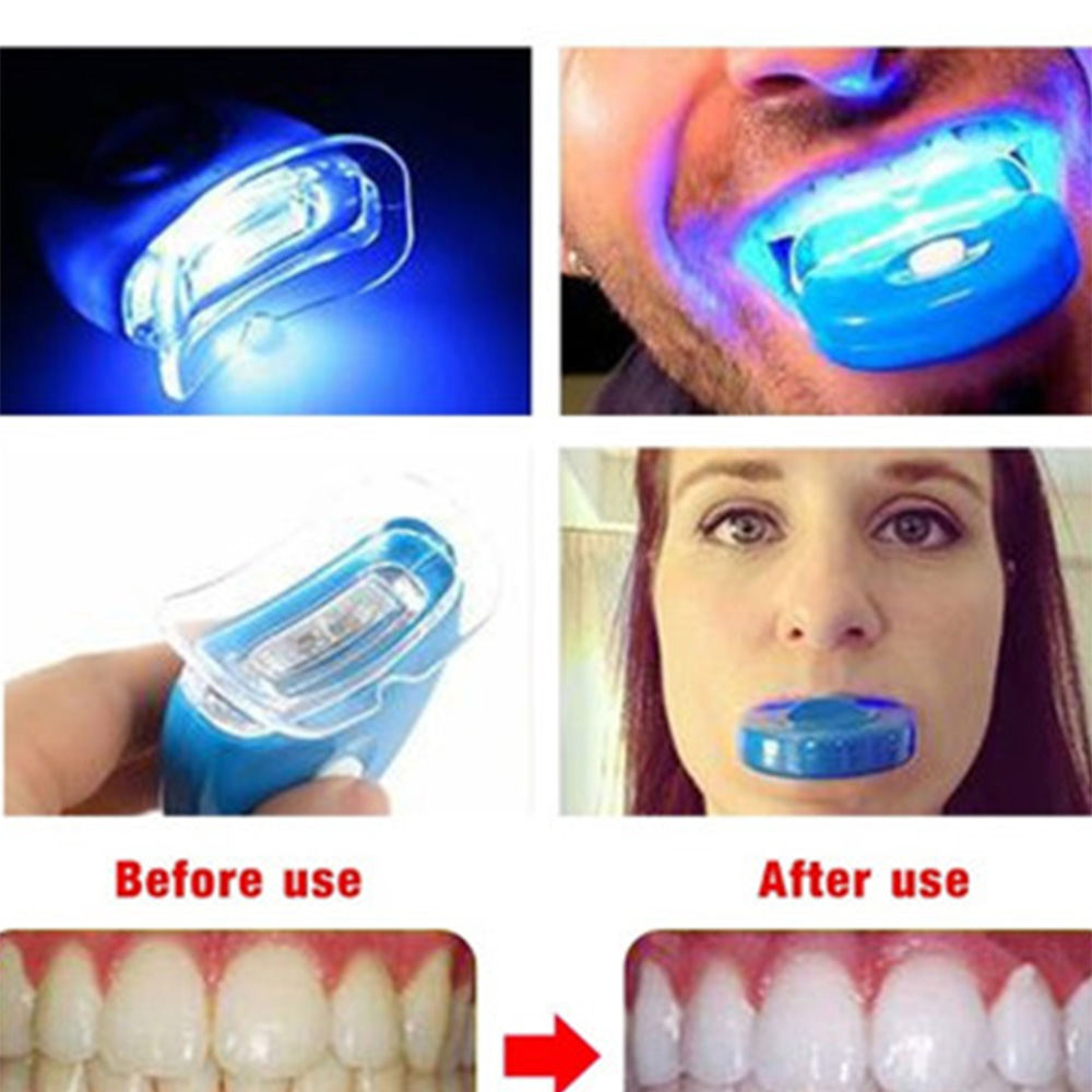 Mới Led Xanh Dương Làm Trắng R - đánh giá và giá Teeth Whitening With Laser